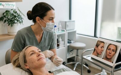 PDO Threads for Jawline and Neck Tightening: What to Expect from a Non-Surgical Lift