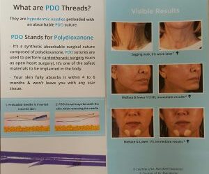 PDO Threads